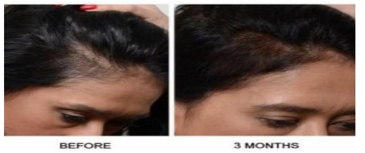 hair loss doctor New Jersey