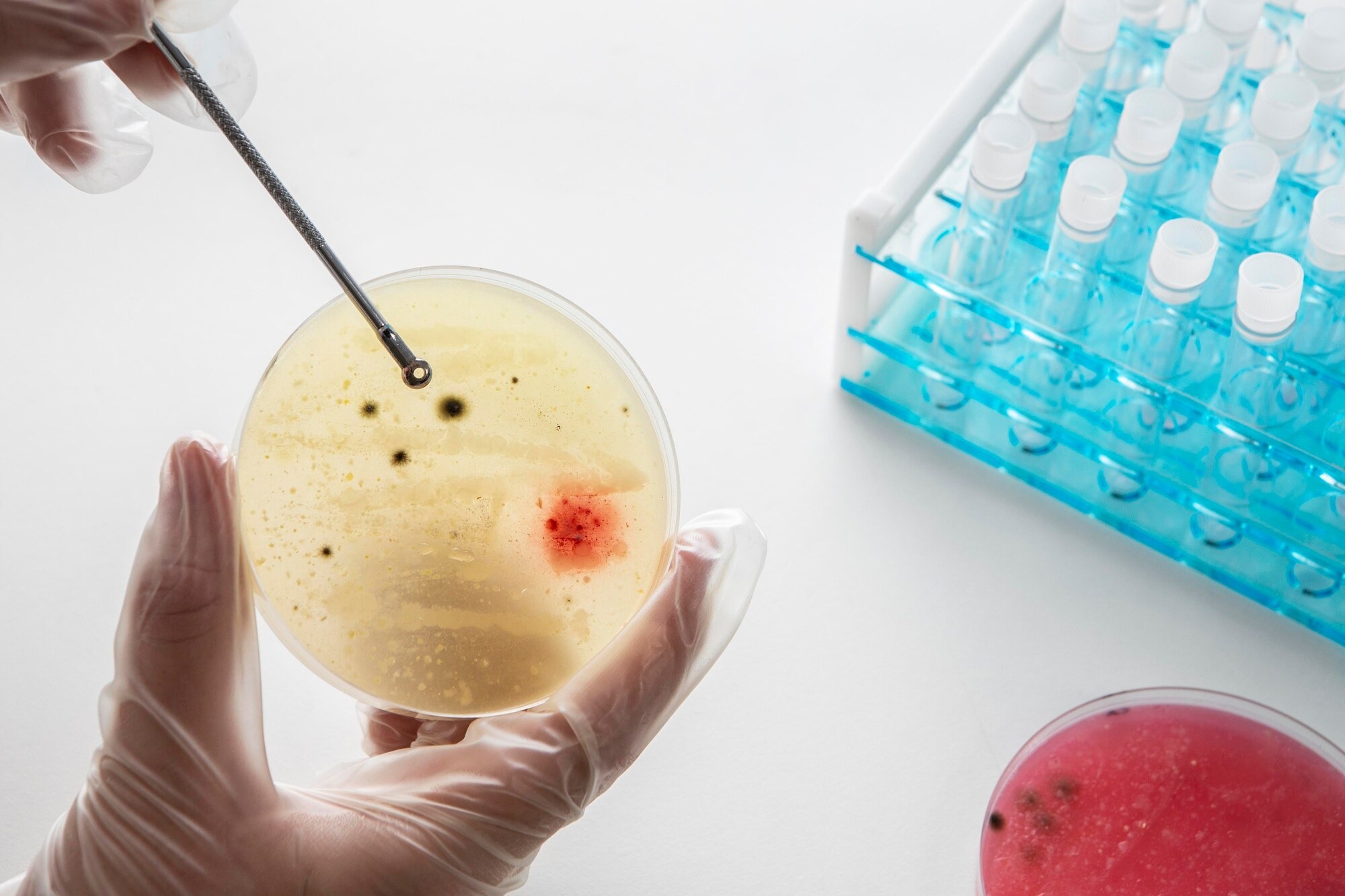 Immunoblot Western Blot