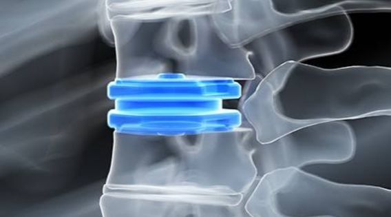 Cervical Spine Treatment India: Expert Cervical Spine Surgeon Kolkata