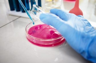 Western Blot Gel Electrophoresis