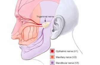 Best Trigeminal Neuralgia Specialist in India: Tips for Living a Normal Life with Trigeminal Neuralgia