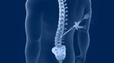 Minimally Invasive Spine Surgery India: Expert Care and Quick Recovery