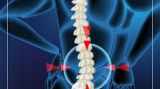RN Tagore Spine Surgeon: Consultant Neuro & Spine Surgeon in Kolkata